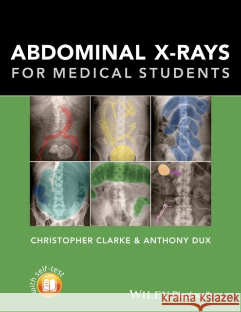 Abdominal X-Rays for Medical Students Clarke, Christopher 9781118600559 John Wiley & Sons - książka