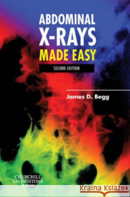 Abdominal X-Rays Made Easy James D Begg 9780443102578  - książka