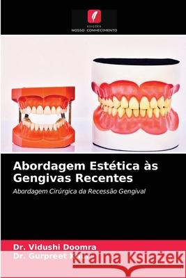 Abordagem Estética às Gengivas Recentes Doomra, Vidushi 9786203678703 Edicoes Nosso Conhecimento - książka