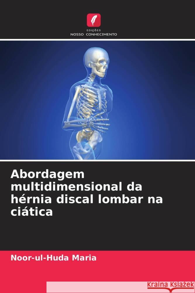 Abordagem multidimensional da h?rnia discal lombar na ci?tica Noor-Ul-Huda Maria 9786207980000 Edicoes Nosso Conhecimento - książka