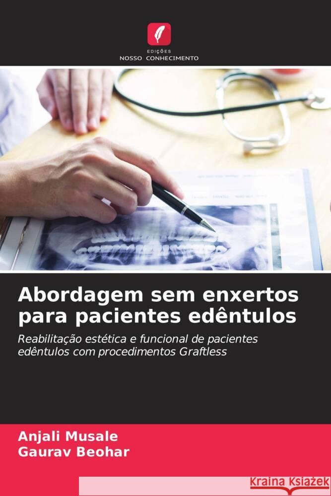 Abordagem sem enxertos para pacientes edêntulos Musale, Anjali, Beohar, Gaurav 9786208570910 Edições Nosso Conhecimento - książka