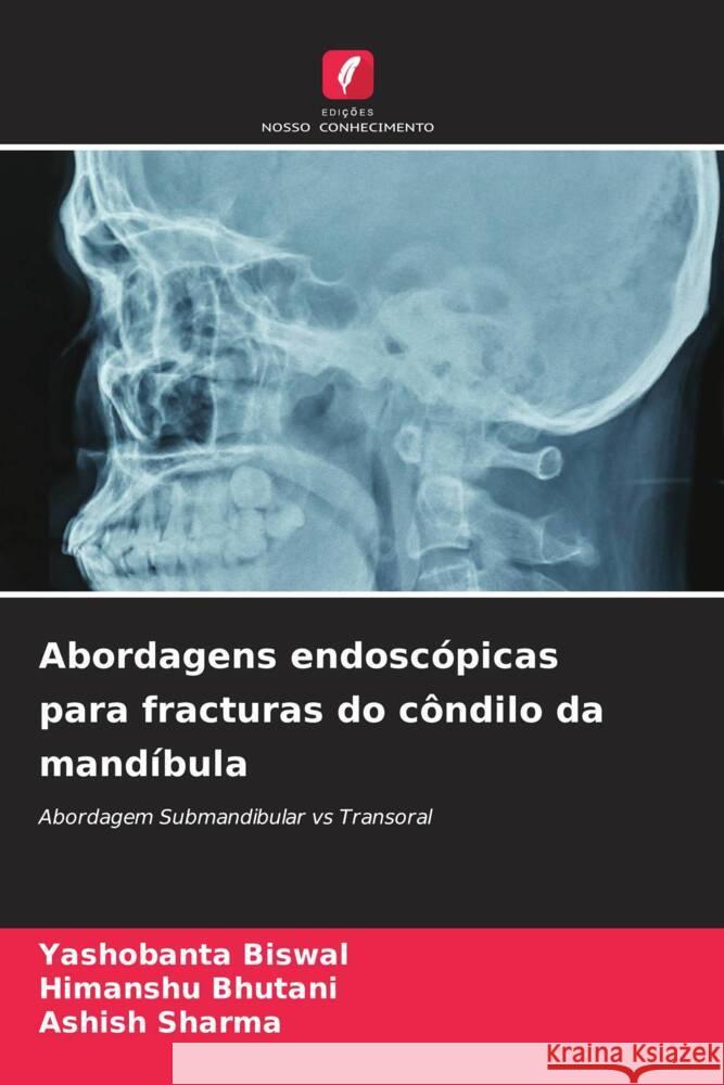 Abordagens endosc?picas para fracturas do c?ndilo da mand?bula Yashobanta Biswal Himanshu Bhutani Ashish Sharma 9786207351527 Edicoes Nosso Conhecimento - książka