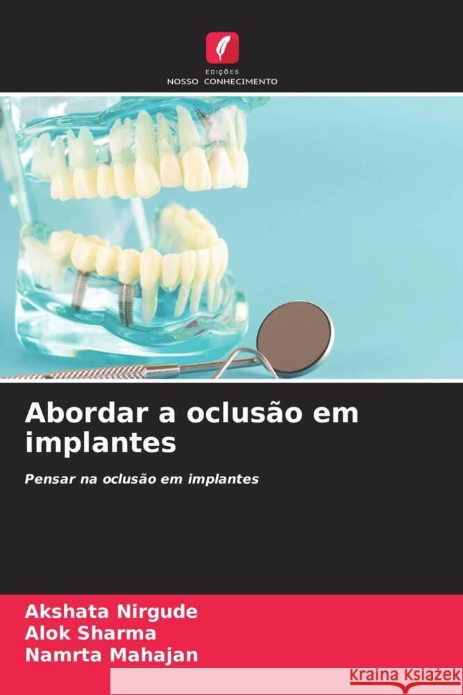 Abordar a oclus?o em implantes Akshata Nirgude Alok Sharma Namrta Mahajan 9786207150441 Edicoes Nosso Conhecimento - książka