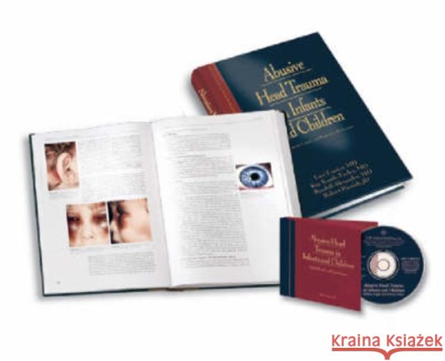 Abusive Head Trauma in Infants and Children: A Medical, Legal and Forensic Reference with Supplementary CD-ROM Kay Rauth-Farley Lori Frasier Robert Parrish 9781878060747 STM Learning - książka