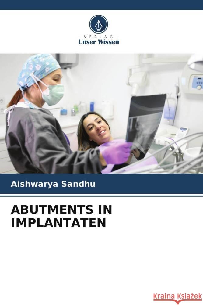 Abutments in Implantaten Aishwarya Sandhu 9786208221119 Verlag Unser Wissen - książka