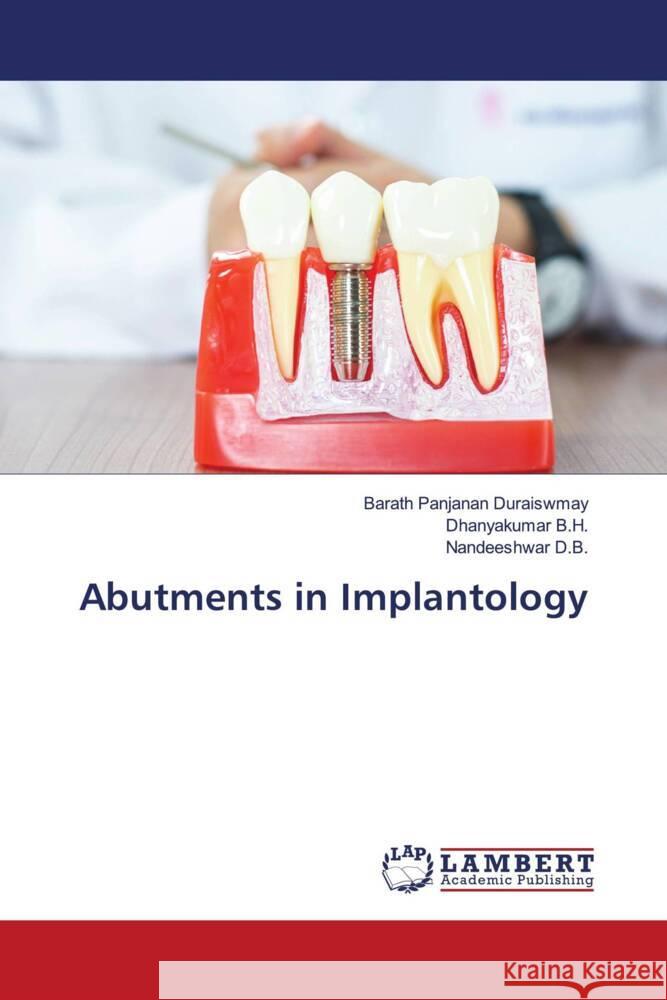 Abutments in Implantology Duraiswmay, Barath Panjanan, B.H., Dhanyakumar, D.B., Nandeeshwar 9786203042122 LAP Lambert Academic Publishing - książka