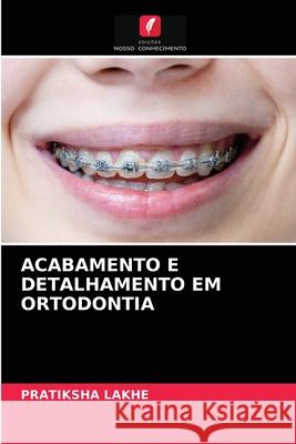 Acabamento E Detalhamento Em Ortodontia Pratiksha Lakhe 9786204036106 Edicoes Nosso Conhecimento - książka