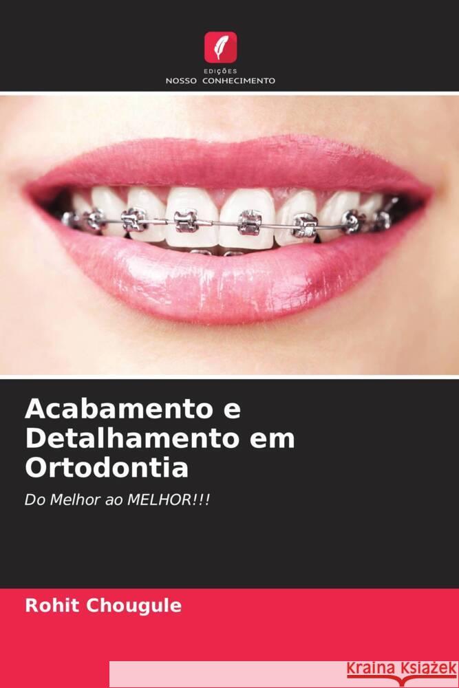 Acabamento e Detalhamento em Ortodontia Chougule, Rohit 9786205038017 Edições Nosso Conhecimento - książka