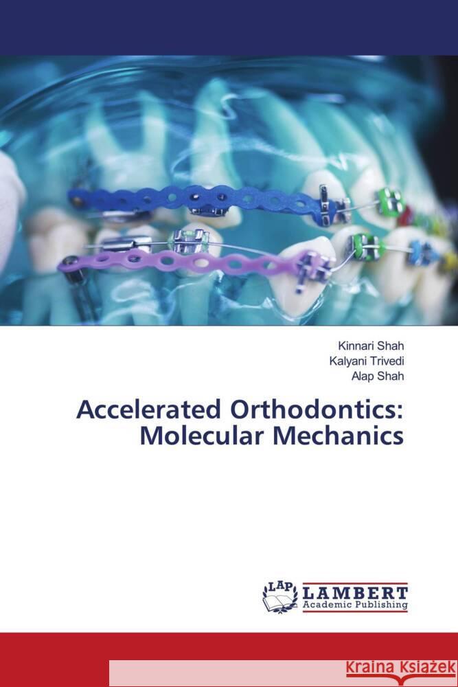 Accelerated Orthodontics: Molecular Mechanics Shah, Kinnari, Trivedi, Kalyani, Shah, Alap 9786205495926 LAP Lambert Academic Publishing - książka