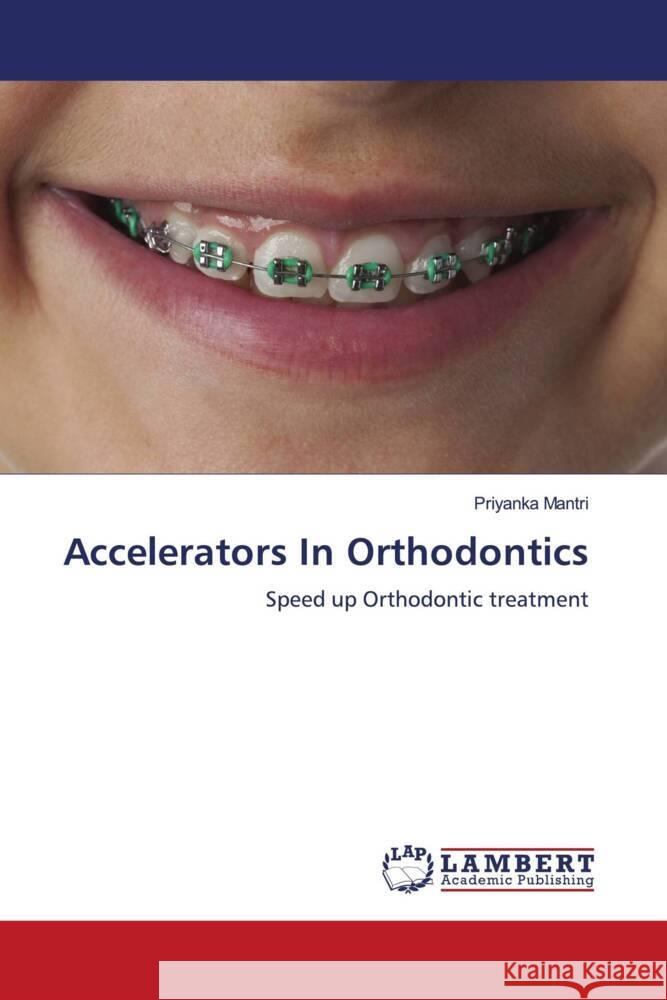 Accelerators In Orthodontics Priyanka Mantri 9786139455720 LAP Lambert Academic Publishing - książka
