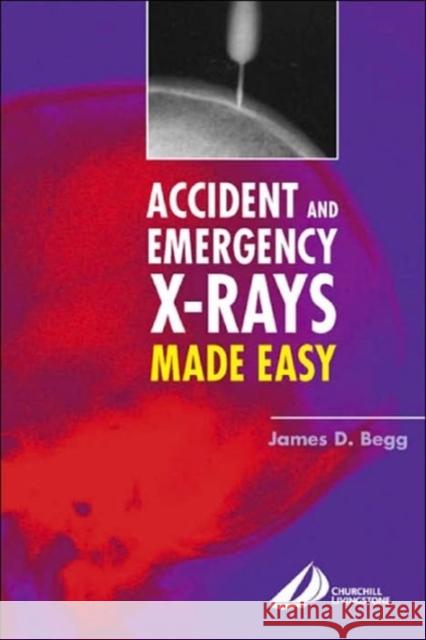 Accident and Emergency X-Rays Made Easy James Begg 9780443073243  - książka