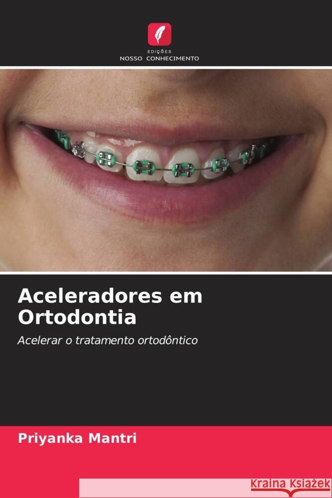Aceleradores em Ortodontia Priyanka Mantri 9786208227616 Edicoes Nosso Conhecimento - książka