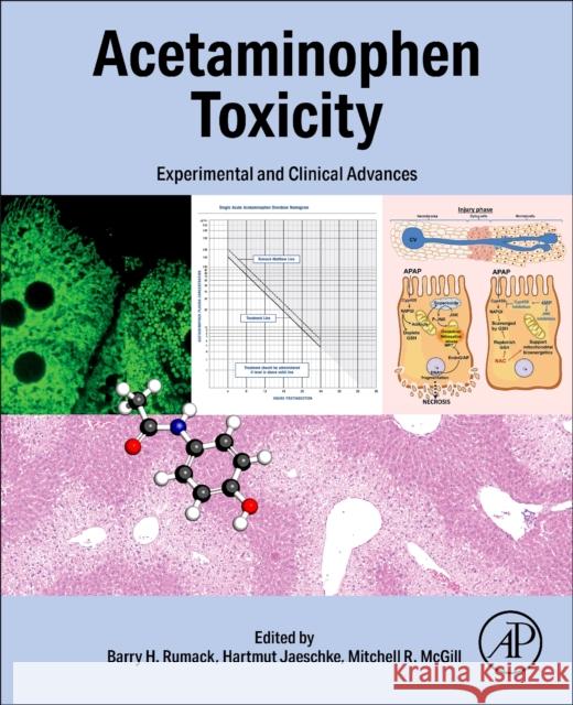 Acetaminophen Toxicity: Experimental and Clinical Advances Barry Rumack Hartmut Jaeschke Mitchell McGill 9780443158773 Academic Press - książka