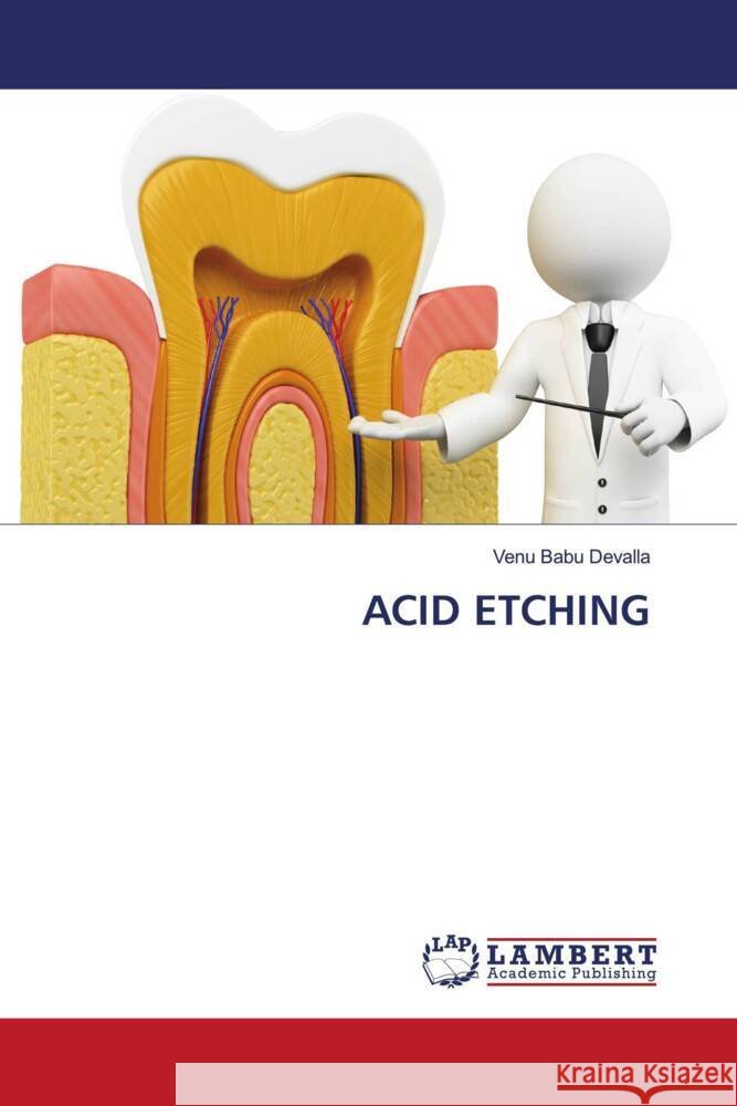 Acid Etching Venu Babu Devalla 9786208009663 LAP Lambert Academic Publishing - książka