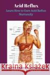 Acid Reflux: Learn How to Cure Acid Reflux Naturally Mr Dermot Farrell 9781546367499 Createspace Independent Publishing Platform