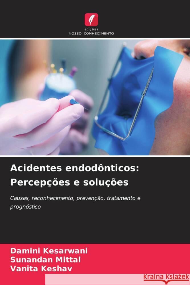 Acidentes endod?nticos: Percep??es e solu??es Damini Kesarwani Sunandan Mittal Vanita Keshav 9786207344222 Edicoes Nosso Conhecimento - książka