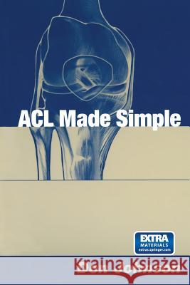 ACL Made Simple Don Johnson 9781475781052 Springer - książka