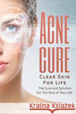 Acne Cure Clear Skin For Life Ashley Dawnson 9781546586920 Createspace Independent Publishing Platform - książka