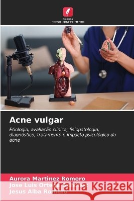 Acne vulgar Aurora Mart?nez Romero Jos? Luis Ortega Sanchez Jesus Alba Romero 9786630358674 Edicoes Nosso Conhecimento - książka