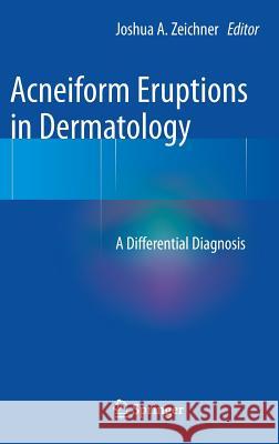 Acneiform Eruptions in Dermatology: A Differential Diagnosis Zeichner, Joshua A. 9781461483434 Springer - książka