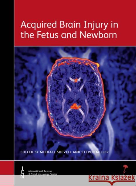 Acquired Brain Injury in the Fetus and Newborn Michael Shevell 9781907655029  - książka