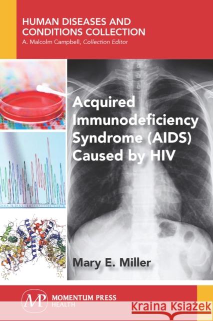 Acquired Immunodeficiency Syndrome (AIDS) Caused by HIV Mary E. Miller 9781944749934 Momentum Press - książka