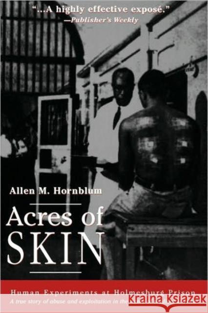 Acres of Skin: Human Experiments at Holmesburg Prison Hornblum, Allen M. 9780415923361 Routledge - książka