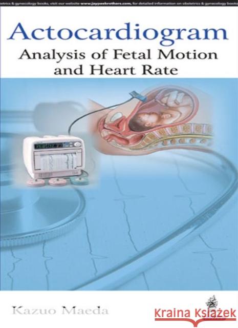 Actocardiogram: Analysis of Fetal Motion and Heart Rate Kazuo Maeda 9789352501861 Jaypee Brothers, Medical Publishers Pvt. Ltd. - książka