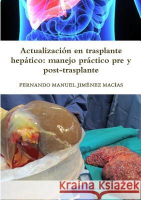 Actualización en trasplante hepático: manejo práctico pre y post-trasplante Jiménez Macías, Fernando Manuel 9780244039875 Lulu.com - książka