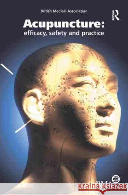 Acupuncture: Efficacy, Safety and Practice Board of Science and Education 9781138181373 Routledge - książka