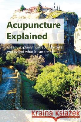 Acupuncture Explained: Clearly explains how acupuncture works and what it can treat Kovich, Fletcher 9781916483002 CuriousPages Publishing - książka