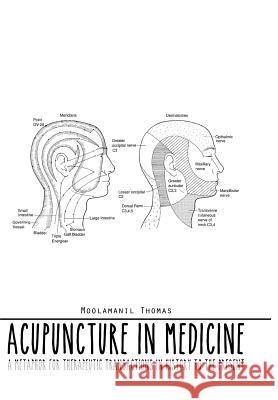 Acupuncture in Medicine: A Metaphor for Therapeutic Transactions in History to the Present Moolamanil Thomas 9781496975768 Authorhouse - książka