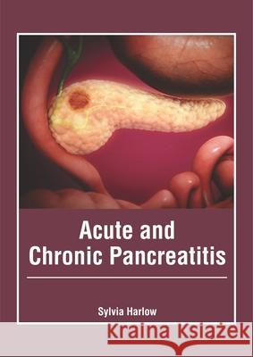 Acute and Chronic Pancreatitis Sylvia Harlow 9781632426772 Foster Academics - książka