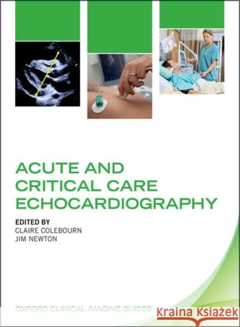 Acute and Critical Care Echocardiography Claire Colebourn Jim Newton 9780198757160 Oxford University Press, USA - książka