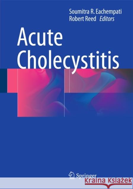 Acute Cholecystitis Soumitra R. Eachempati R. Lawrence Ree 9783319148236 Springer - książka