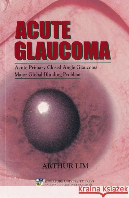 Acute Glaucoma : Acute Primary Closed Angle Glaucoma - a Major Global Blinding Problem  9789810459482 Singapore University Press - książka