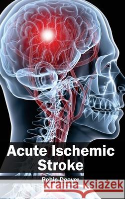 Acute Ischemic Stroke Robin Deaver 9781632410078 Hayle Medical - książka