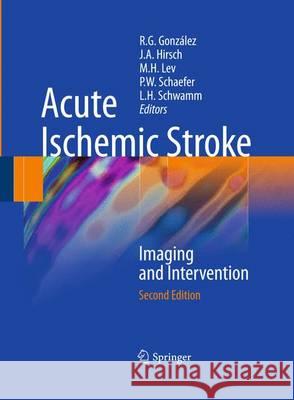 Acute Ischemic Stroke: Imaging and Intervention González, R. Gilberto 9783642423529 Springer - książka