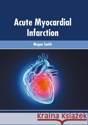 Acute Myocardial Infarction Megan Smith 9781639270125 American Medical Publishers - książka