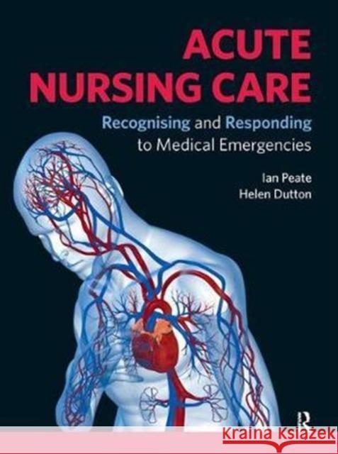 Acute Nursing Care: Recognising and Responding to Medical Emergencies Peate, Ian 9781138454378  - książka