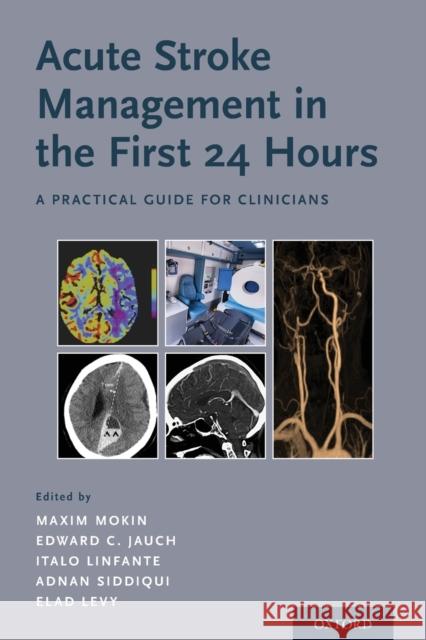 Acute Stroke Management in the First 24 Hours: A Practical Guide for Clinicians Maxim Mokin Edward C. Jauch Italo Linfante 9780190856519 Oxford University Press, USA - książka