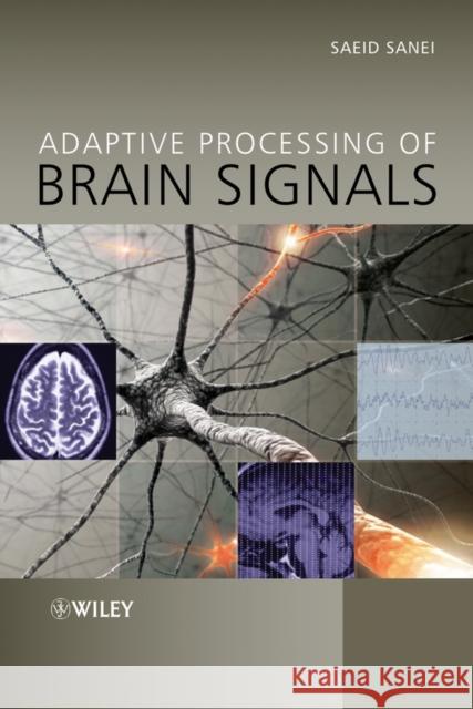 Adaptive Processing of Brain Signals Sanei, Saeid 9780470686133 John Wiley & Sons - książka