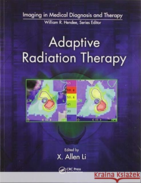 Adaptive Radiation Therapy X. Allen Li 9780367577001 CRC Press - książka