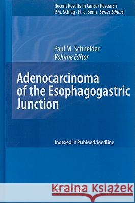 Adenocarcinoma of the Esophagogastric Junction Paul M. Schneider 9783540705789 Springer - książka