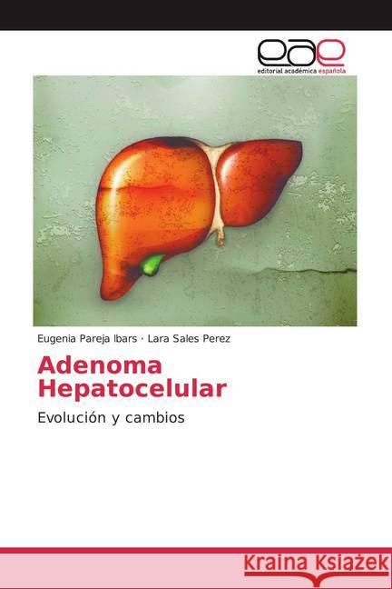 Adenoma Hepatocelular : Evolución y cambios Pareja Ibars, Eugenia; Sales Perez, Lara 9786139441204 Editorial Académica Española - książka