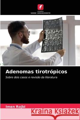 Adenomas tirotrópicos Imen Rojbi 9786204085821 Edicoes Nosso Conhecimento - książka