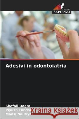 Adesivi in odontoiatria Shefali Dogra, Piyush Tandan, Mansi Nautiyal 9786204155227 Edizioni Sapienza - książka