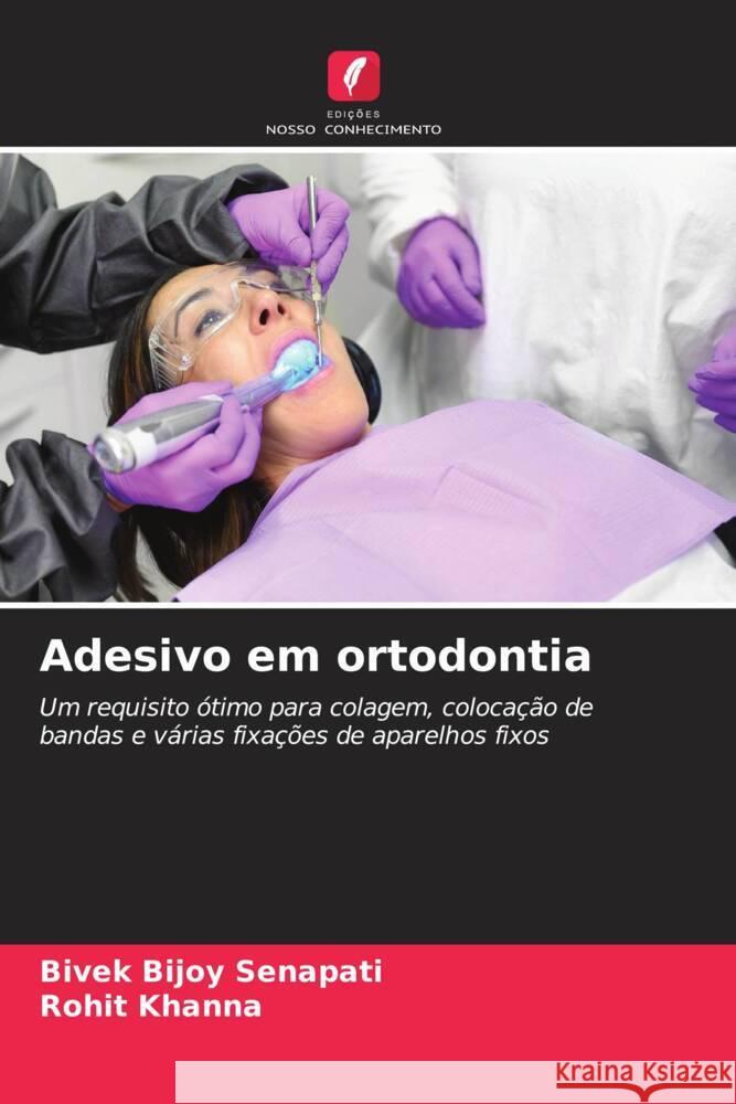 Adesivo em ortodontia Senapati, Bivek Bijoy, Khanna, Rohit 9786206441786 Edições Nosso Conhecimento - książka