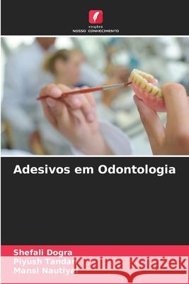 Adesivos em Odontologia Shefali Dogra, Piyush Tandan, Mansi Nautiyal 9786204155234 Edicoes Nosso Conhecimento - książka