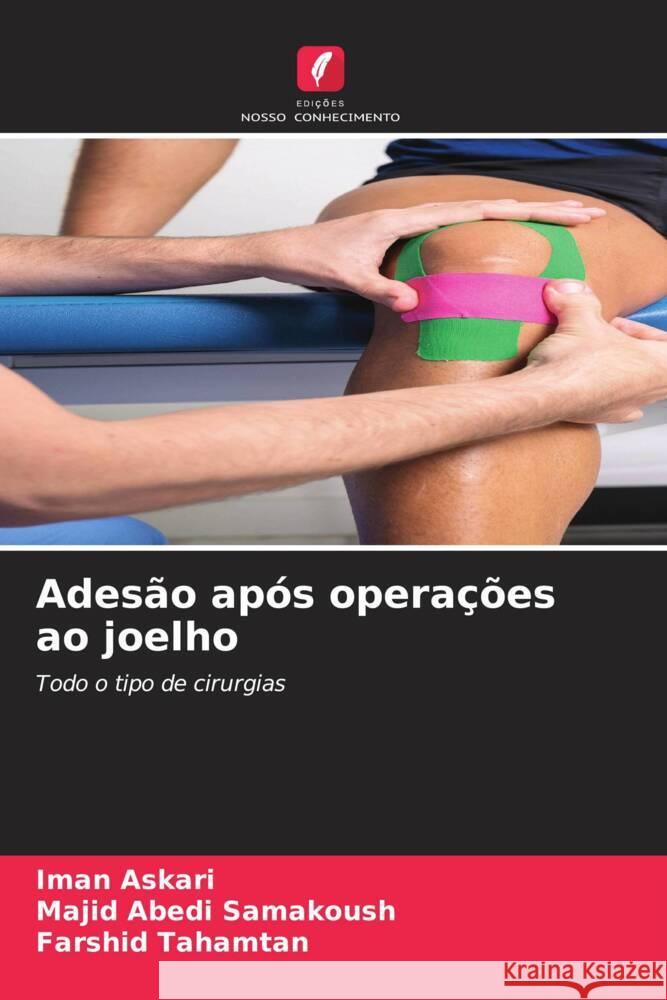 Ades?o ap?s opera??es ao joelho Iman Askari Majid Abedi Samakoush Farshid Tahamtan 9786206928638 Edicoes Nosso Conhecimento - książka